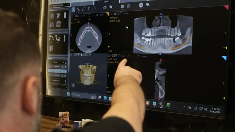Dr. Andi Mavriqi pianifica un intervento su TAC CBCT 3D